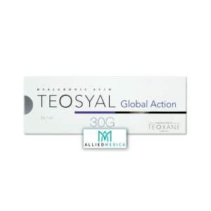 TEOSYAL® 30G GLOBAL ACTION